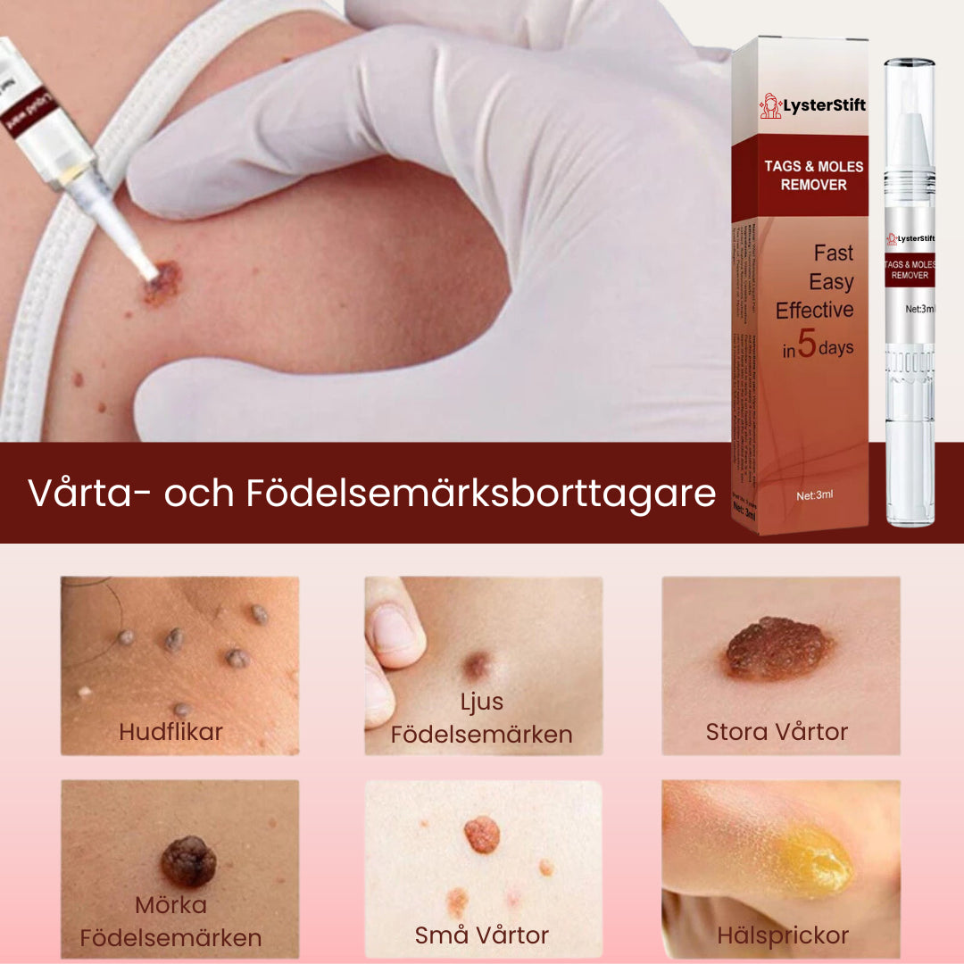 LysterStift™ | Säg Hej Då Till Vårtor och Födelsemärken Med Enkelhet!