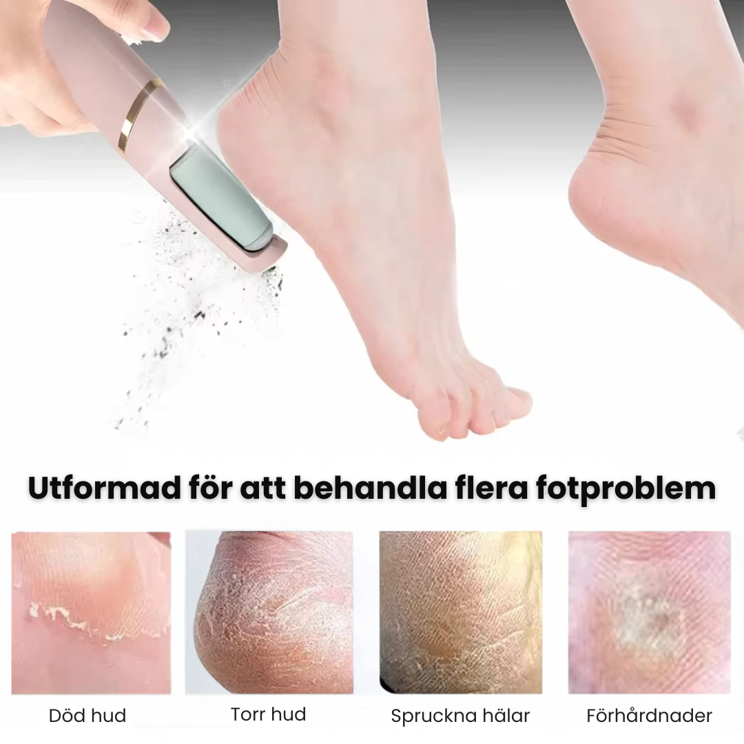 SilkPro™ | Mjuka fötter utan dyra salongsbesök