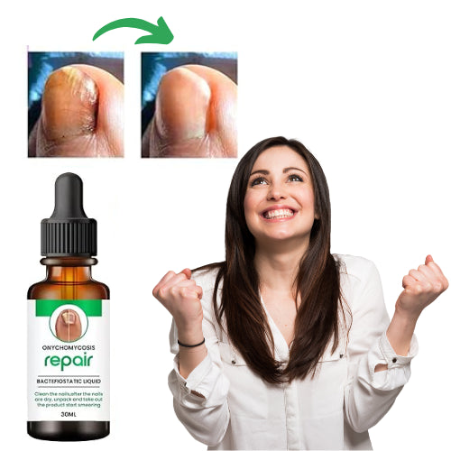 BeautyNails™ Nagelserum | Återställer svampnaglar synligt inom 7 dagar!