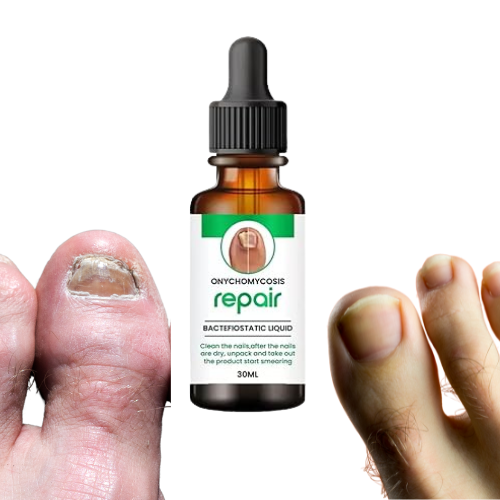 BeautyNails™ Nagelserum | Återställer svampnaglar synligt inom 7 dagar!